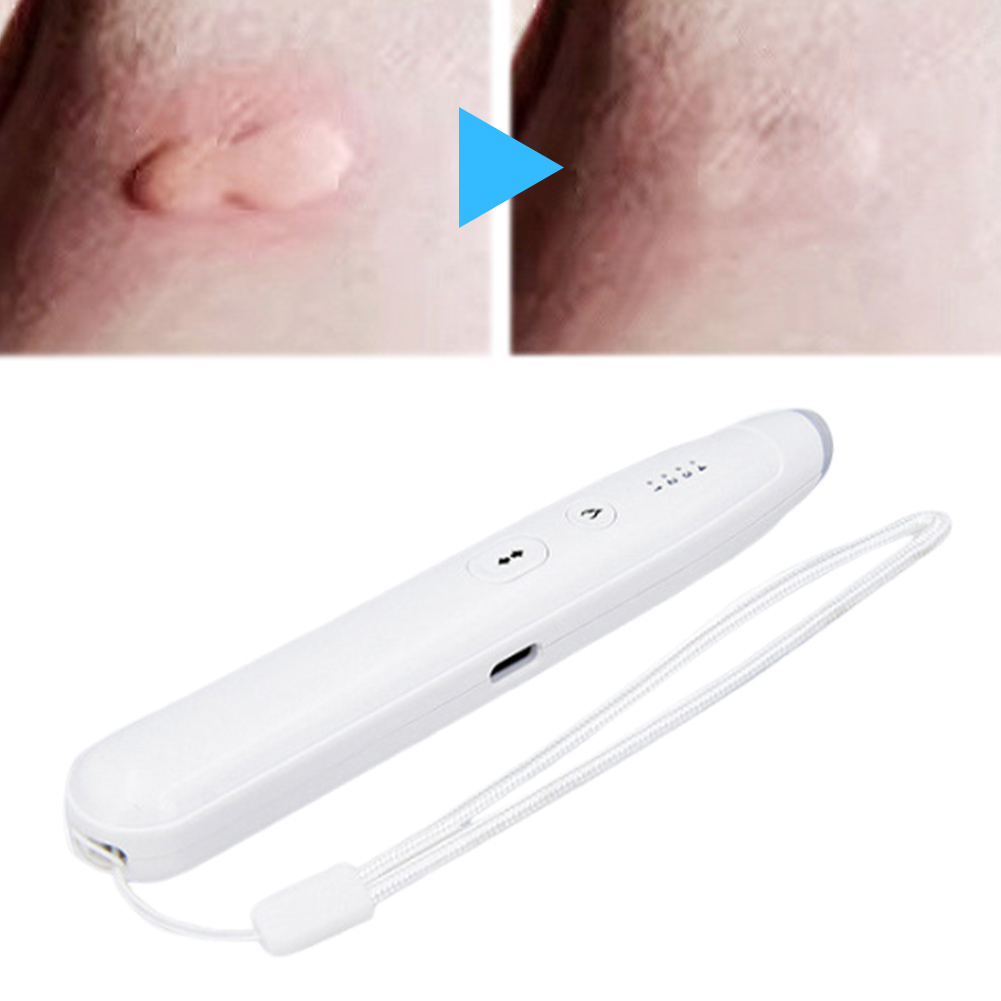 Electronic Mosquito Bite Pen N - огляд і ціна Outdoor Power Pedestal
